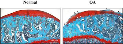 Predictive and concurrent validity of pain sensitivity phenotype, neuropeptidomics and neuroepigenetics in the MI-RAT osteoarthritic surgical model in rats